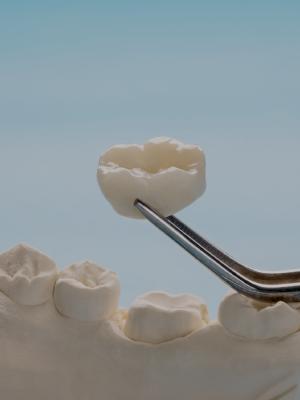 Dental Crowns Near Me in Norwalk, CA